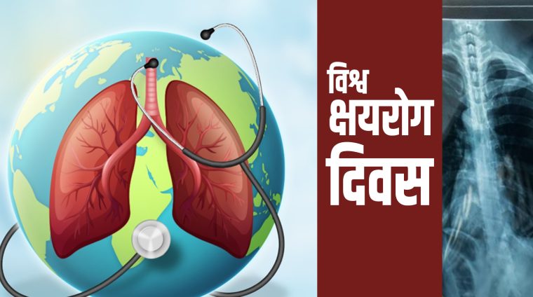 ‘हो हामी क्षयरोग अन्त्य गर्छौँ’ र ‘राष्ट्रिय अभियान: हाम्रो योगदान’ मुल नाराका साथ विश्व क्षयरोग दिवस मनाईदै